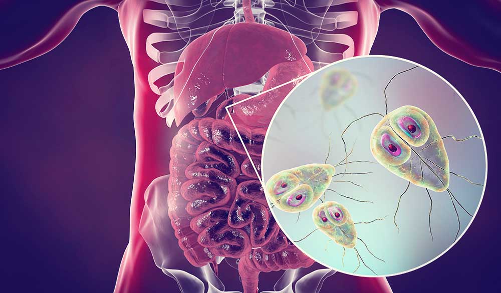 Giardia Antigen آزمایشگاه وحید