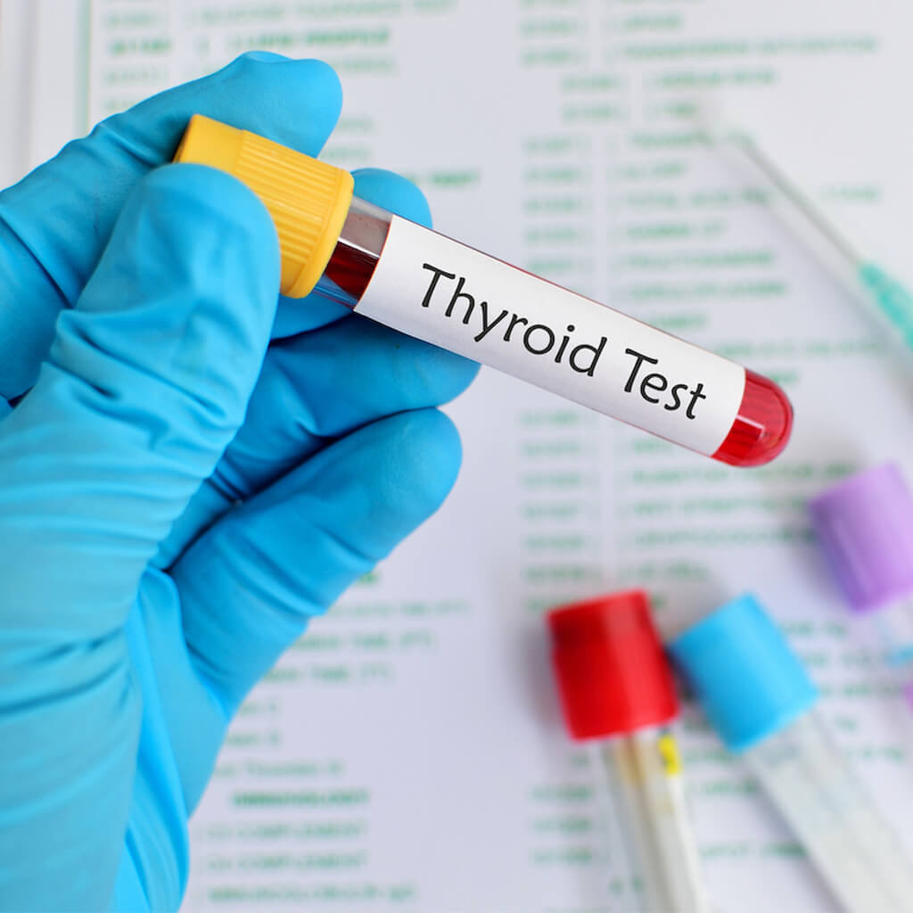 thyroid test-thumb