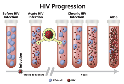 HIV Progression