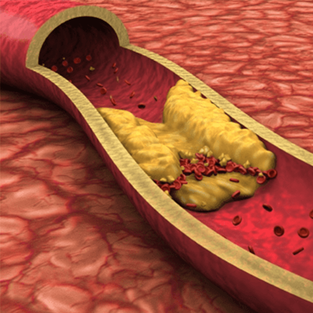 non-hdl-cholesterol