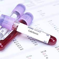 calcitonin